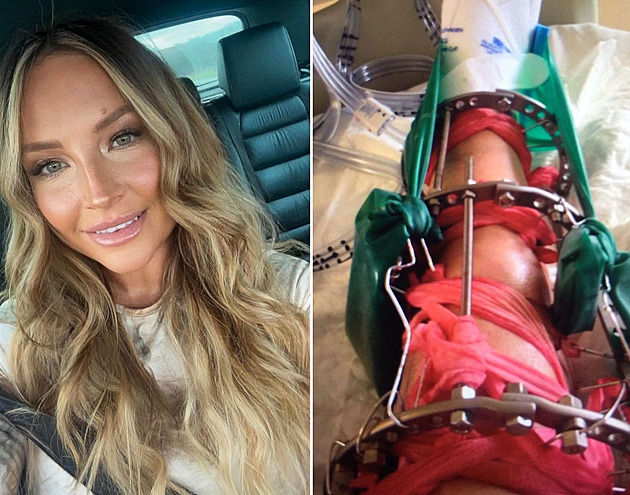 Na bolest nohy dostala žena mast, ve skutečnosti šlo o rakovinu