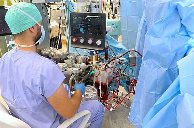 Novinka v Česku. Ústecká nemocnice má unikátní přístroj pro mimotělní oběh